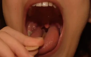 I Eat the Popsicle and Suck on It. After I Eat the Popsicle, I Examine My Mouth and Throat with the Popsicle Stick