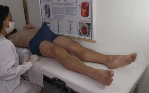Nurse Observes Patient’s Erection